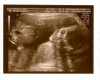 20 weeks ultrasound!!